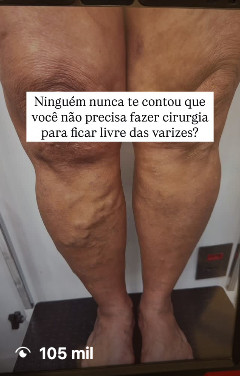 Conteúdo viral