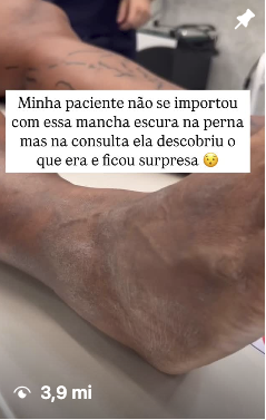 Conteúdo viral