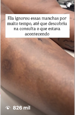Conteúdo viral